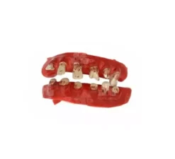Denti da pirata deteriorati
