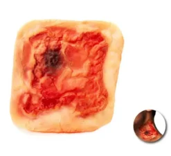 Falsa cicatrice rossastra adulta